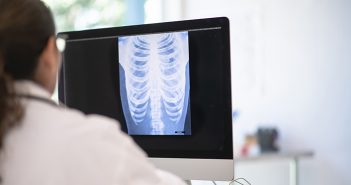 A doctor sits at their desk and looks at an x-ray of someone's chest. They are in a bright sterile office.