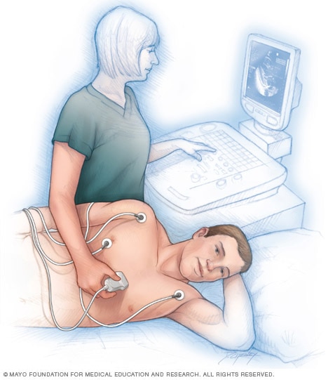 Echocardiogram being performed