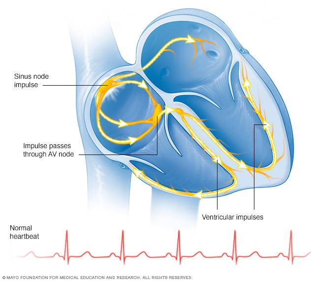 Typical heartbeat