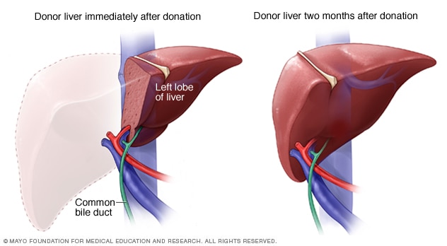 Living-donor liver organ regeneration