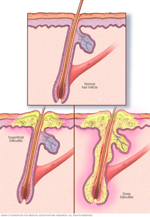 St Elizabeth Healthcare Condition