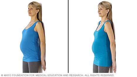 Pregnant person doing a standing pelvic tilt