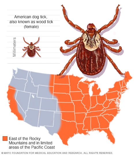 American dog tick