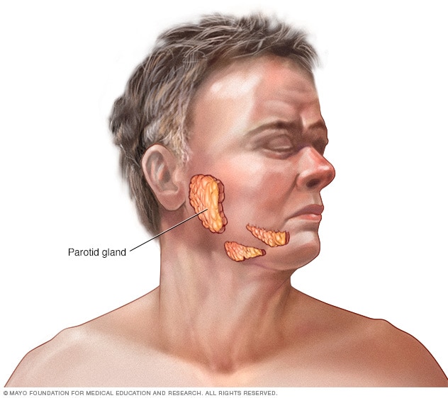 Parotid gland