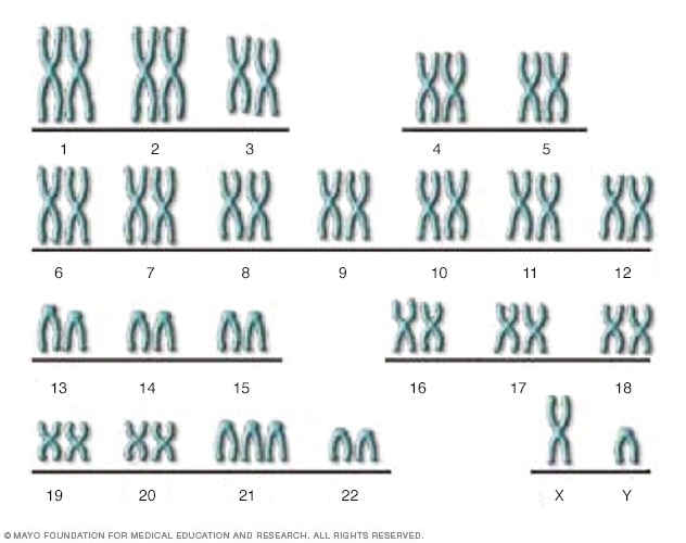 The chromosomes of someone with Down syndrome