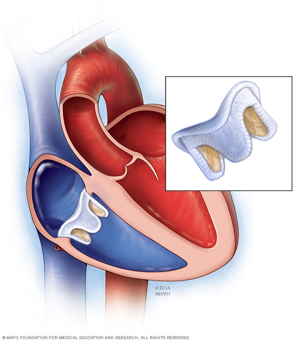 Biological tricuspid valve