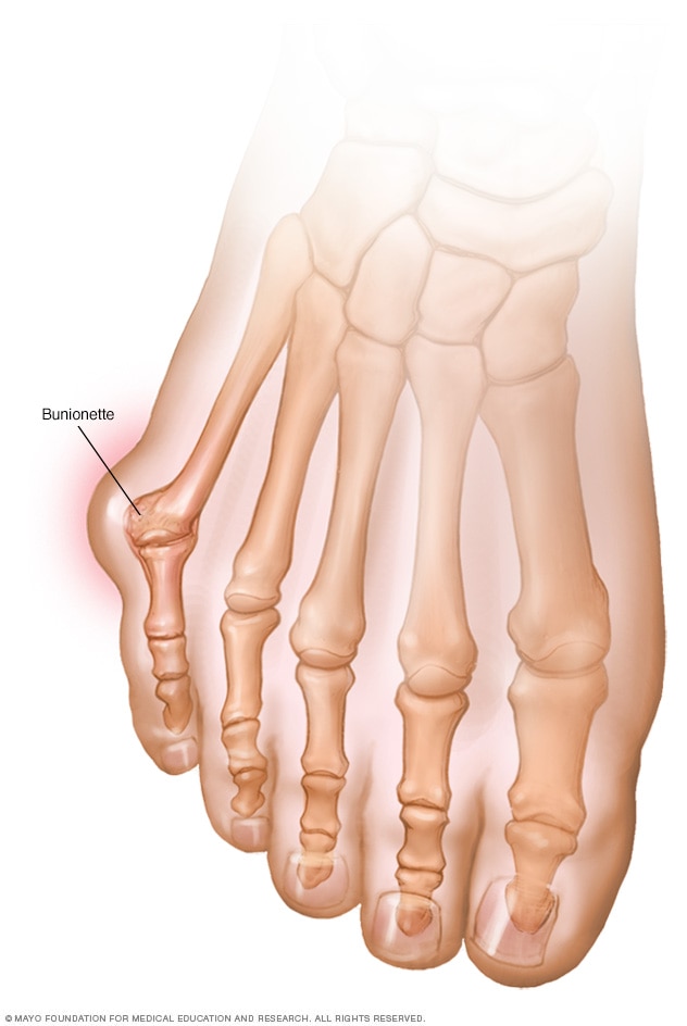 St Elizabeth Healthcare Condition st-elizabeth-healthcare-condition