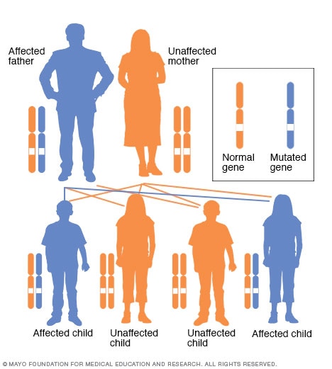 Autosomal dominant inheritance pattern