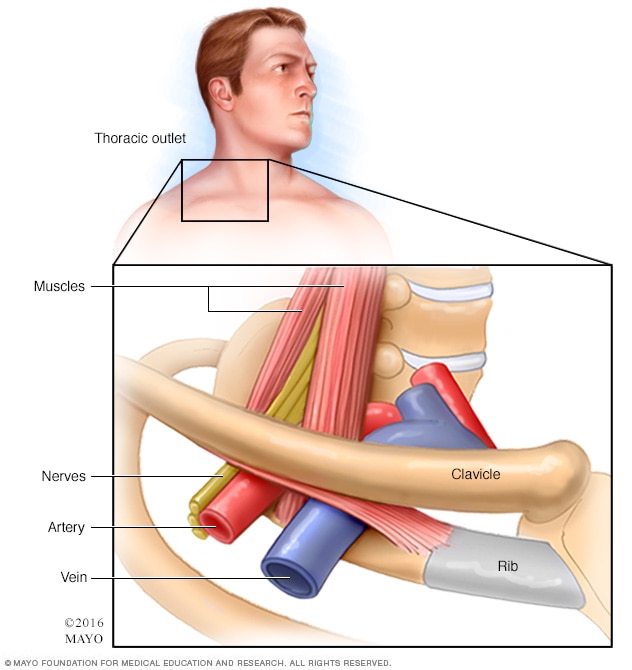 Thoracic outlet