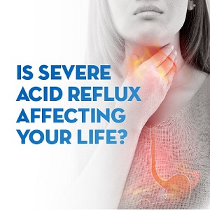 is severe acid reflux affecting your life